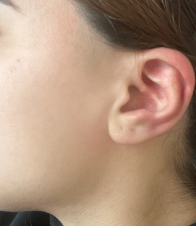 After